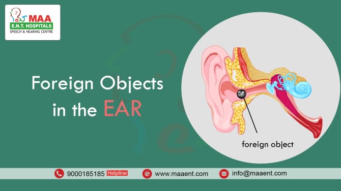 Foreign Body, Ear Treatment